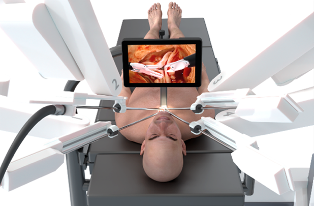 A designed image of the new CardioPrecision, robot-assisted heart valve surgery.