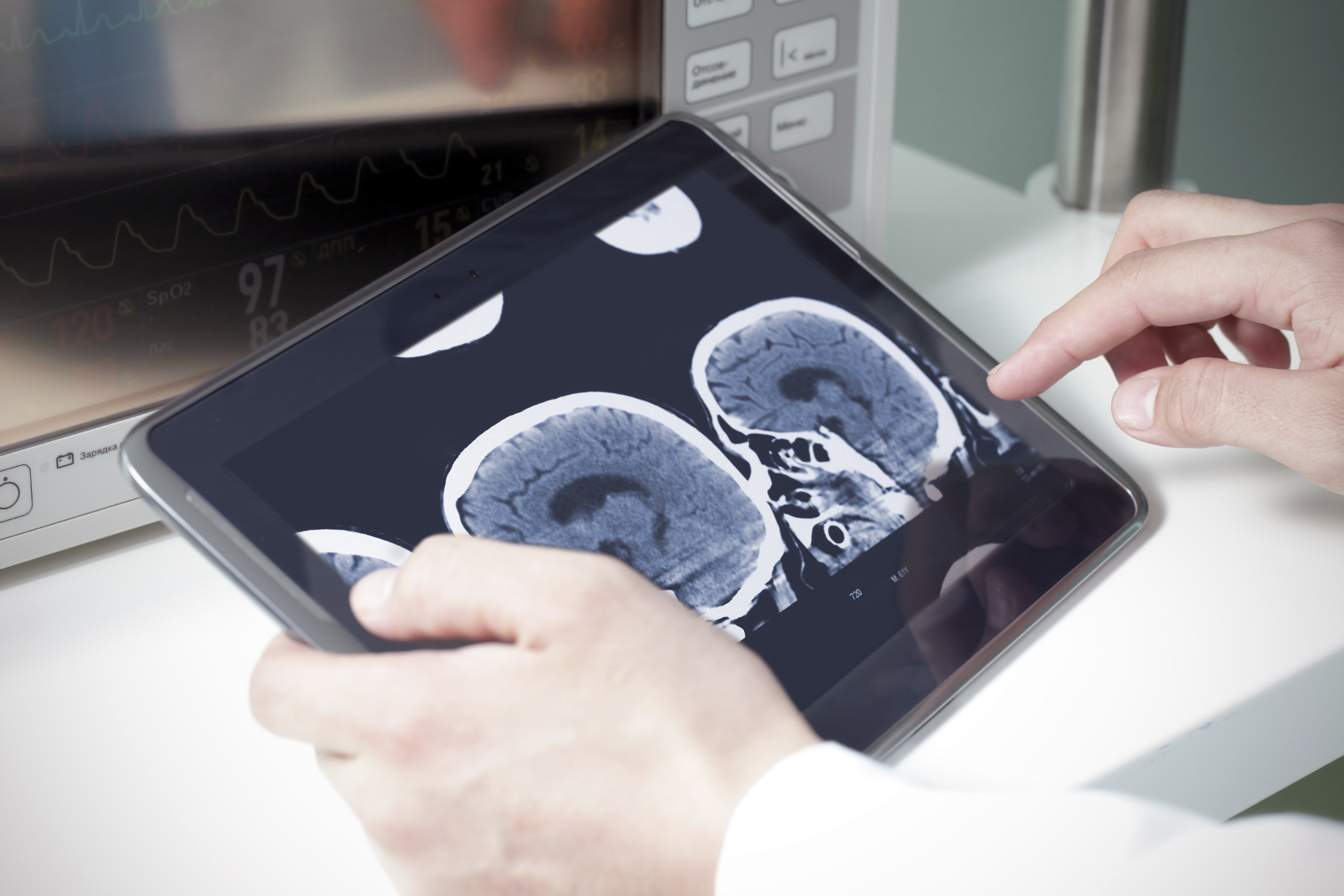 A brain scan being viewed on a tablet by a healthcare professional.